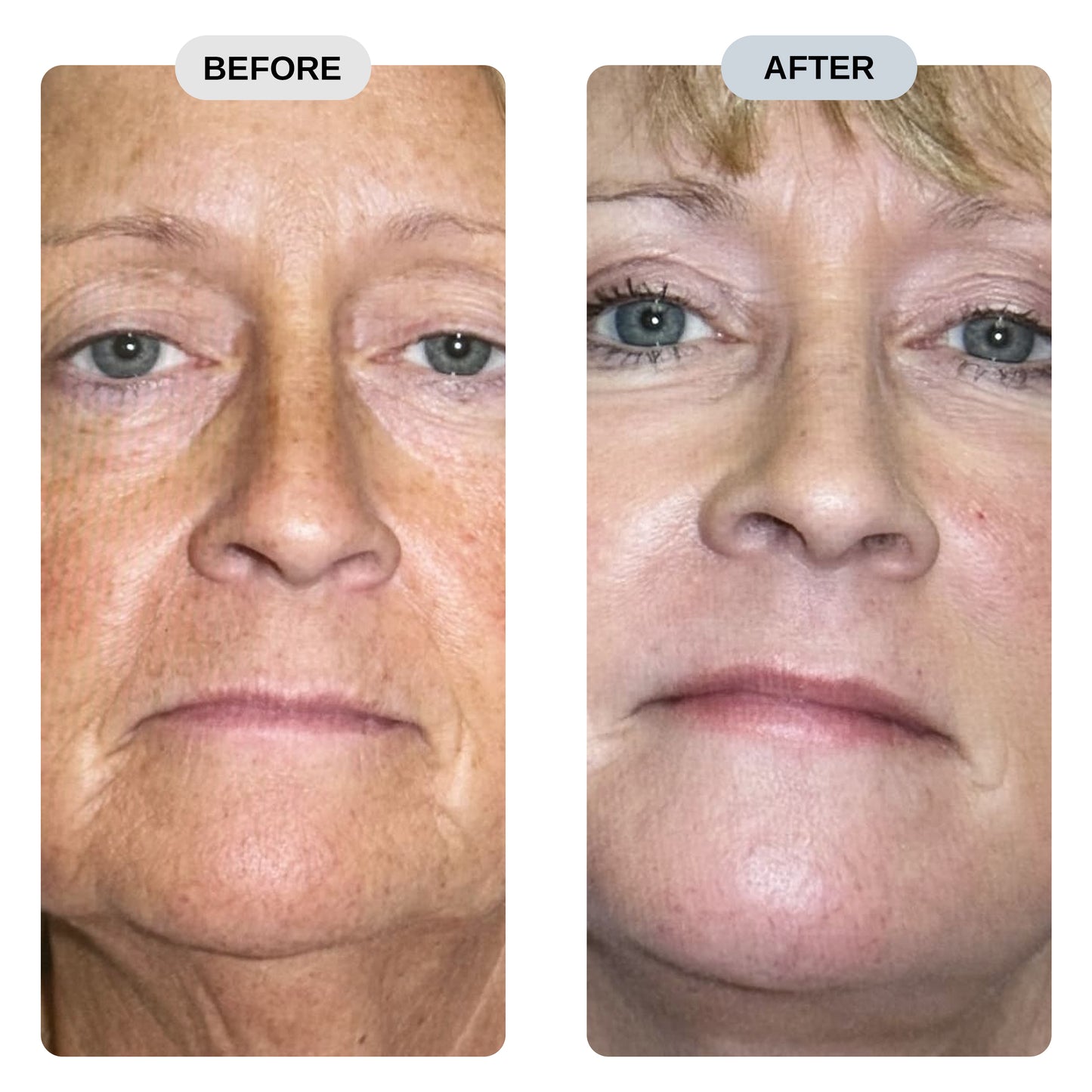 Rejuva Pro™ Pure NMN