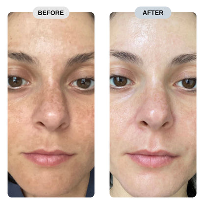 Rejuva Pro™ Pure NMN