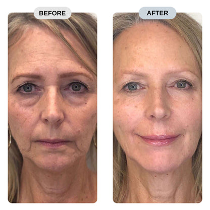 Rejuva Pro™ Pure NMN